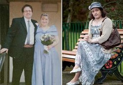 Perempuan Hermafrodit Hidup Sebagai Laki-laki Selama 41 Tahun