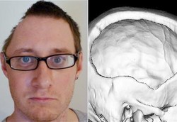 Kepala Penyok Ditambal Pakai Lemak Perut Sendiri