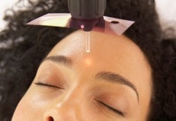 Terapi Laser Bisa Perbaiki Kerusakan Kulit Akibat Penuaan