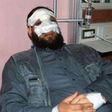 Berbohong Soal Operasi Hidung, Anggota Parlemen Mesir Mundur