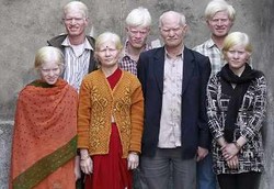 Ini Dia Keluarga Albino Terbesar di Dunia