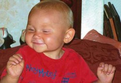 Manusia Bunglon, Kulitnya Jadi Oranye Kalau Makan Wortel