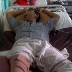 Empat Bonek Luka Masih Dirawat di RSUD Bojonegoro