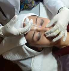 Makin Cantik dengan Hidung Mancung dan Dagu Membelah