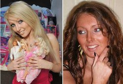 Wajah Diobok-obok Pisau Bedah Demi Secantik Boneka Barbie