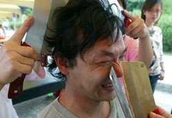 Terapi Aneh, Wajah dan Kepala Ditekan-tekan Pakai Pisau Daging