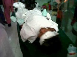 Tangan Dua Korban Bom Pipa Semarang Hancur