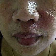 Serangga Tomcat Serbu Penghuni Apartemen Elit Eastcoast