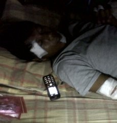 Korban Ledakan Bom Pipa: Kami Kira itu Mainan