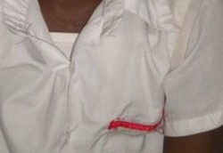 Siswa Pengidap HIV di Sekolah Tanzania Harus Pakai Pita Merah