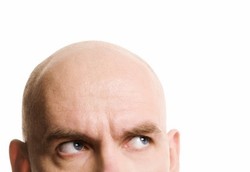 Kebotakan Dini Bisa Menandakan Adanya Tumor Prostat