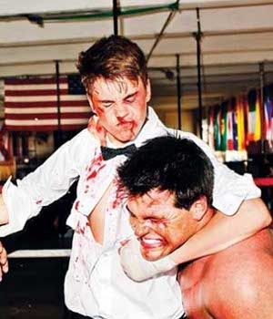 Justin Bieber Bonyok!