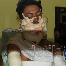 Tabrak Kios Bensin, Seorang Biker & Penambal Ban Hangus Terbakar