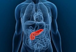 Pancreatitis, Radang pada Pankreas