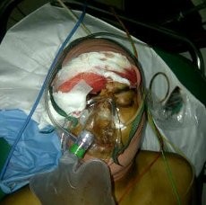 Brigadir Jaka Sempat Menembak Perampok yang Mengeroyoknya