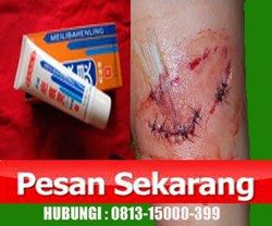 RAMUAN HERBAL PENGHILANG BEKAS LUKA