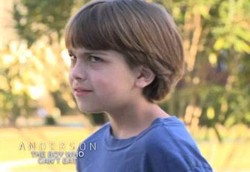 Terpaksa Makan Pakai Selang Karena Alergi Semua Makanan