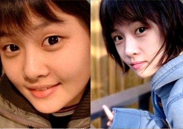 Boram T-ara Sebelum & Sesudah Operasi Plastik Boram T-ara Sebelum & Sesudah Operasi Plastik