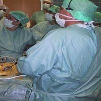 2 Wanita Kembar China Operasi Ganti Kelamin