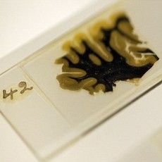 Otak Si Jenius Albert Einstein akan Dipamerkan di Inggris