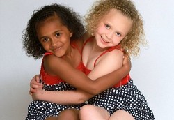 Kembar Tapi Beda Warna, Satu Hitam Satu Putih