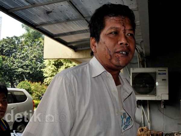 Korban Air Keras Demo DPR Lapor Polisi
