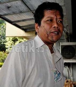 Cairan Kimia di Demo BBM, Jenis Asam Konsentrasi Rendah