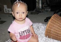 Cepat Sakit Karena Tak Punya Sistem Kekebalan Tubuh T-sel