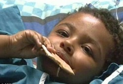 Bocah AS Harus Dioperasi Karena Tak Bisa Berhenti Tertawa