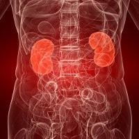 Cara Terbebas dari Batu Ginjal