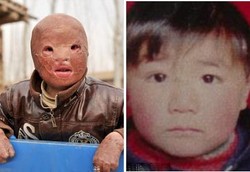 Bocah Tanpa Wajah, Mukanya Rata Seperti Pakai Topeng