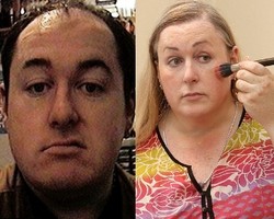 Ganti Kelamin, Mantan Miliuner Ini Habiskan Rp 1,7 Miliar