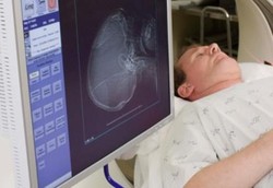 Scan Otak Bisa Prediksi Kehidupan Seks dan Berat Badan