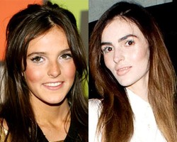 7 Selebriti dengan Hasil Bedah Plastik yang Gagal