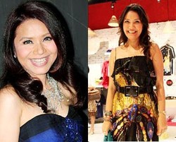 Ini Dia Selebriti Indonesia yang Operasi Plastik