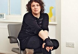 Sindrom Langka, Mengucapkan Kata Biskuit 900 Kali/Jam