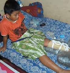 Korban Smackdown Pelajar SD di Situbondo Bertambah