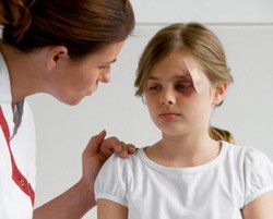 Saat Anak Jatuh & Kepalanya Terbentur