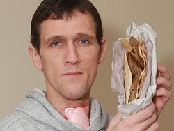 Pria Ini Selamat karena Pakai Kebab sebagai Perban