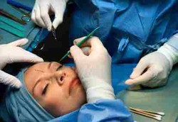 7 Peringkat Negara dengan Jumlah Operasi Plastik Terbanyak