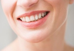 Produk Pemutih Gigi dapat Merusak Enamel