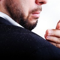 Biangnya Ketombe Ditemukan, Penyebabnya Jamur