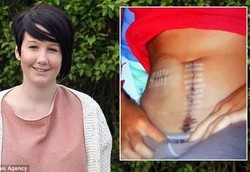 Harus Makan Langsung Lewat Jantung Karena Usus Tak Bekerja