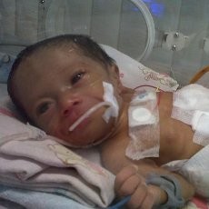 Biaya Operasi Bayi Alma Butuh Biaya Besar