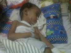 Bocah Penderita Hydrocephalus & Tumor Batang Otak Itu Kian Lemah, Ibu Pasrah