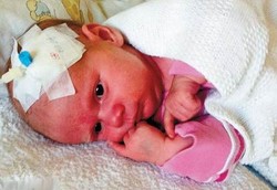 Bayi Tanpa Imunitas, Bisa Meninggal Hanya Karena Dicium