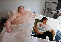 Pria Tergemuk di Dunia dan Tampangnya Saat Masih Kurus