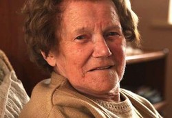 Berkat Donor Kulit dari Orang Meninggal, Luka 20 Tahun Sembuh