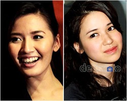 16 Seleb Indonesia yang Bermasalah dengan Jerawat (Bag.2)