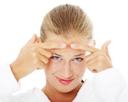 1 dari 6 Wanita Putus Asa Karena Jerawatnya